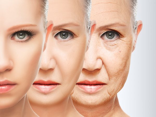 Image from a post with the title: Stave Off Wrinkles with a Low Sugar Diet.