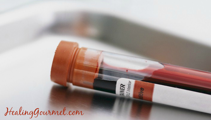 blood test CRP