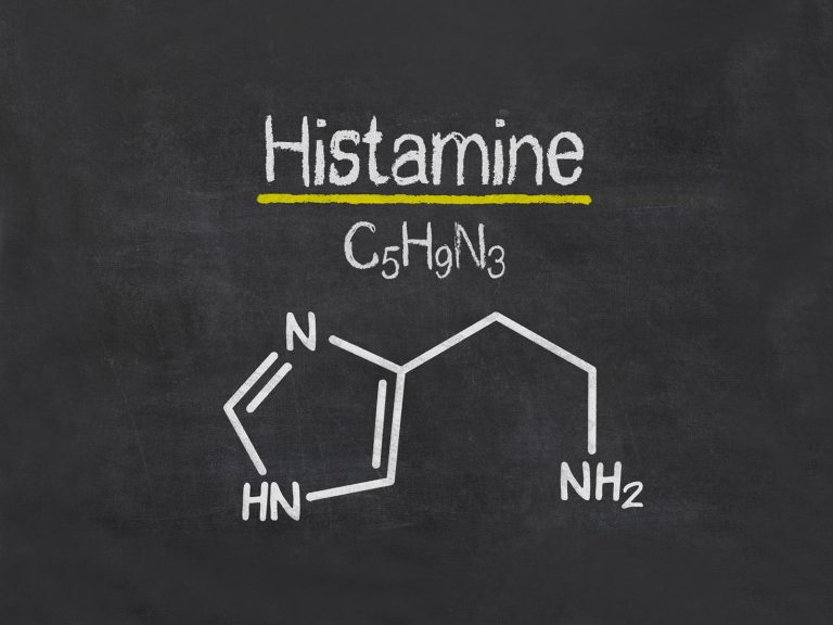 histamine intolerance